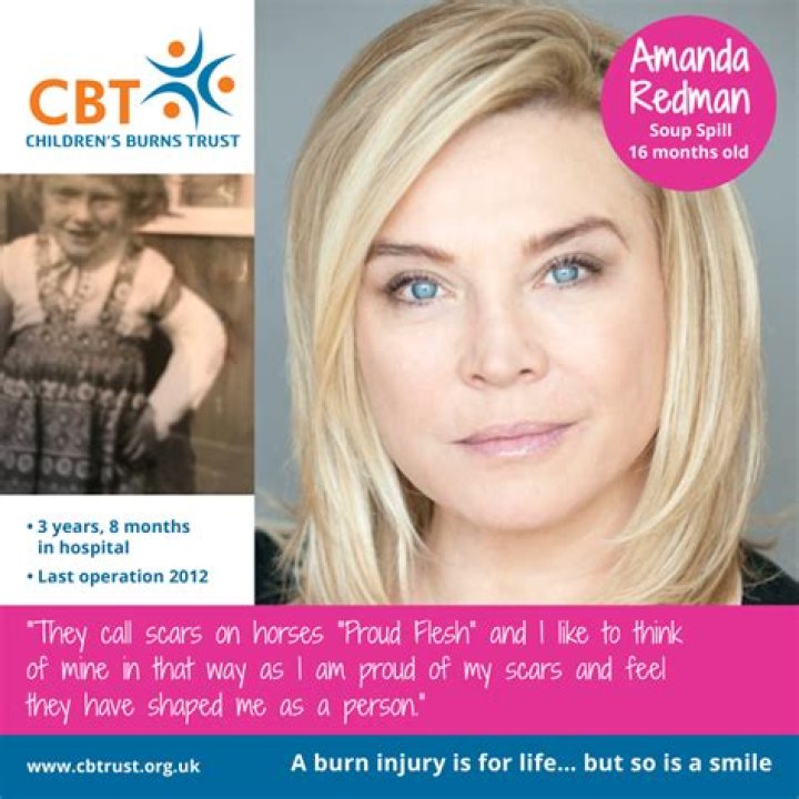 Amanda Redman: Bio, Career & More
