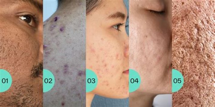 Diva Flawless: Bio, Age & More - All You Need to Know!