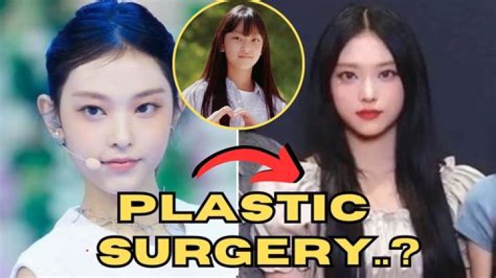 Hikaru Nagi: Truth About Plastic Surgery Rumors