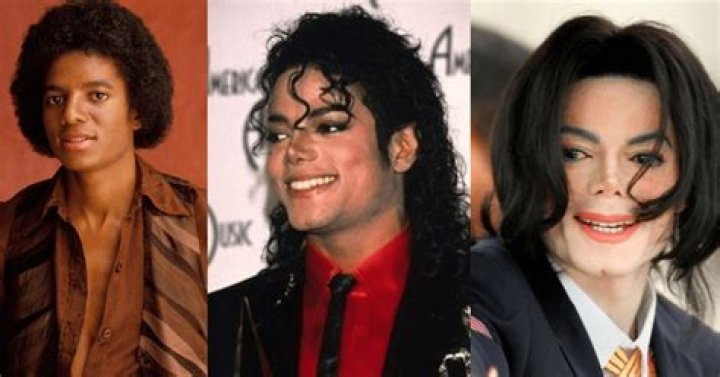 Michael Jackson's Vitiligo: Truth & Legacy