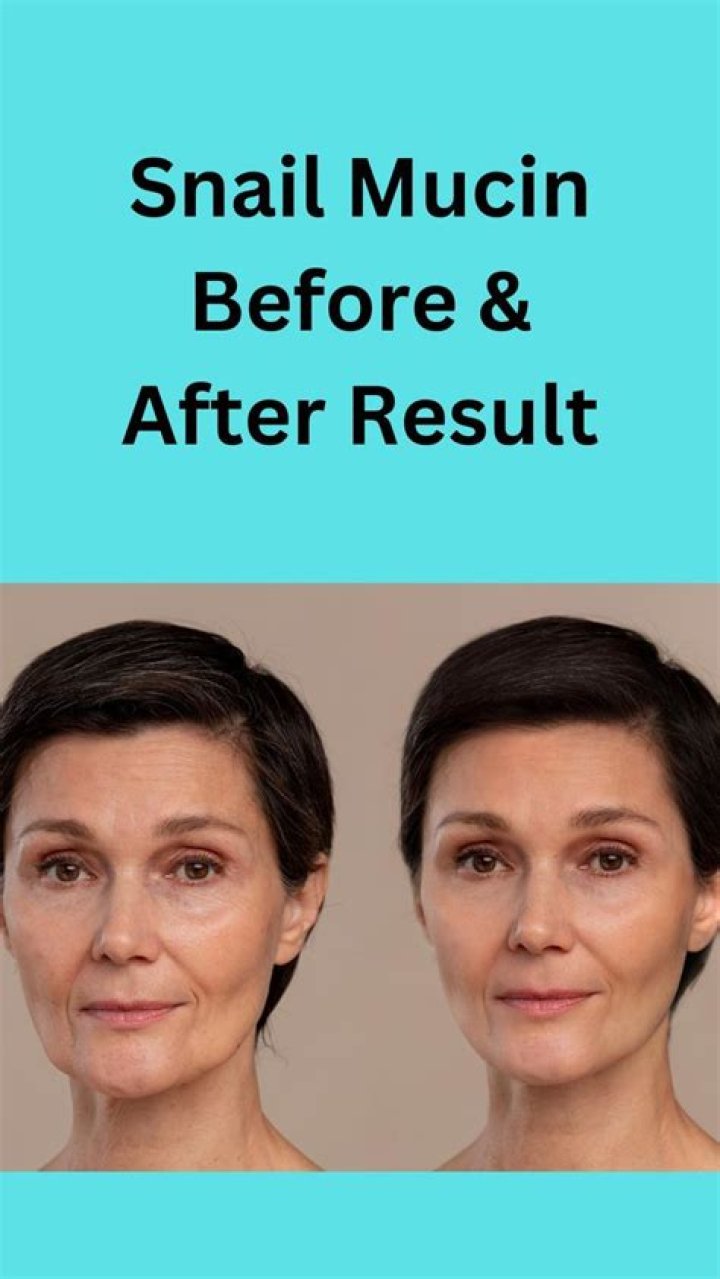 Snail Mucin: Benefits, Uses & Before/After Results